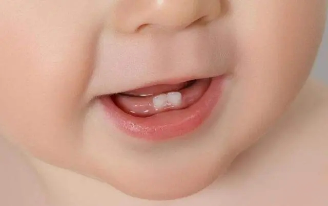 1-3个月长牙齿期间，哪些需要注意？